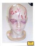 Photo 23: Model of Marilyn Sheppard's Head by Cuyahoga County Coroner's Office