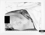 Defendant's Exhibit 076-39: Close Up Of Marilyn's Abdomen by Cleveland/Bay Village Police Department