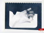 Defendant's Exhibit 078-03: Marilyns Hand by Cuyahoga County Coroner's Office