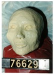 Model 01. Model head, front view by Cuyahoga County Prosecutor's Office and Cuyahoga County Coroner's Office