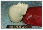 Model 03. Model head, side view by Cuyahoga County Prosecutor's Office and Cuyahoga County Coroner's Office