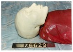 Model 04. Right side of model head by Cuyahoga County Prosecutor's Office and Cuyahoga County Coroner's Office